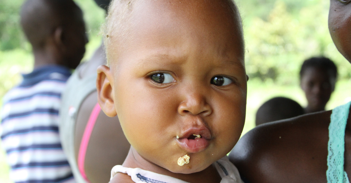 A child who has recovered from Kwashiorkor